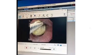 Sản phụ mới sinh suýt mất mạng vì nuốt mật lợn 