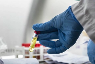 WHO thông tin về ca tử vong đầu tiên do virus cúm A/H5N2