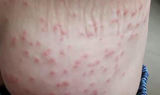 Nước biển gây ngứa, Đà Nẵng lấy mẫu truy nguyên nhân