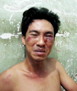 Hạ gục tên trộm uy hiếp công an