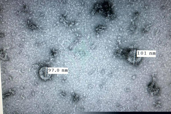 72 giờ nuôi cấy virus corona mới của Việt Nam