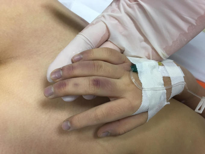 Ảnh chụp cháu bé- được cho là đã tử vong trước khi tới bệnh viện.(Ảnh: Công luận)