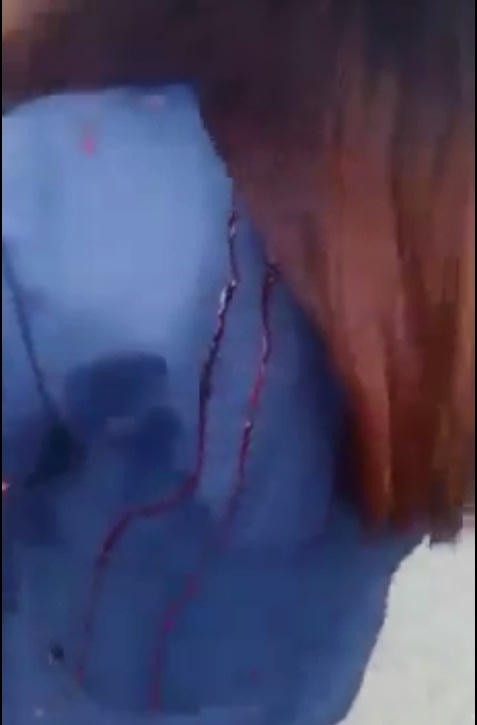 Máu nhuộm đỏ màu áo xanh của nạn nhân.