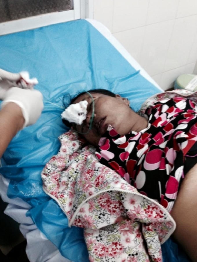 Hai nạn nhân may mắn đã được cấp cứu kịp thời.