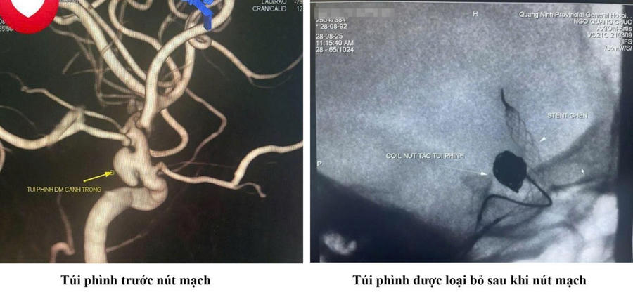 Hình ảnh trước và sau khi can thiệp.