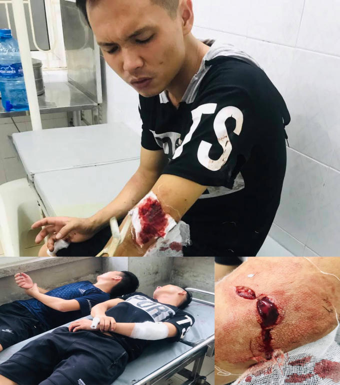 Nạn nhân nhà hàng Hưng Thịnh 1 phải nhập viện cấp cứu