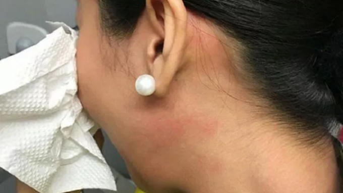 Nữ tiếp viên nữ bị thương sau cái tát cả hành khách Bình.