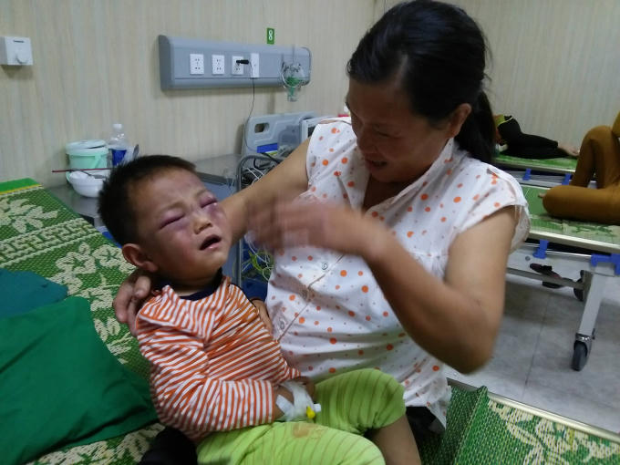 Bé Hiếu phải nhập viện điều trị do bị cha dượng đánh đập.