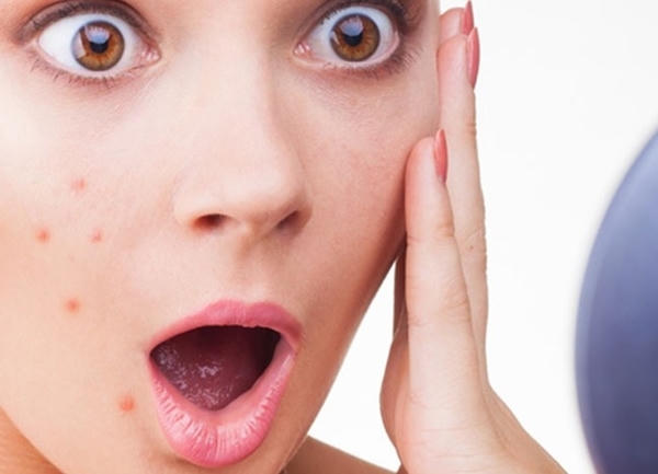 Da nhạy cảm dễ bị phản ứng với các thành phần mỹ phẩm. Ảnh: internet