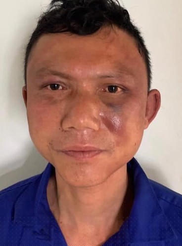 Đối tượng Dân (ảnh tư liệu).