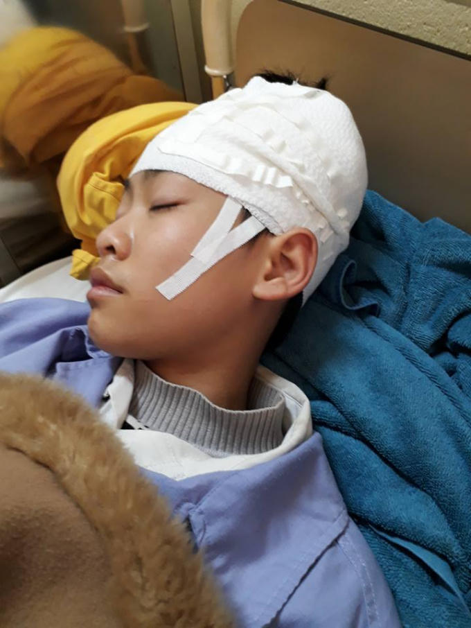 Học sinh Cao Kiên Cường học sinh trường THCS Xuân Sơn (Thị xã Đông Triều, tỉnh Quảng Ninh) bị thầy giáo tát 2 cái vào má khiến e phải nhập viện cấp cứu. Ảnh: Facebook Nguyễn Thị Nở.