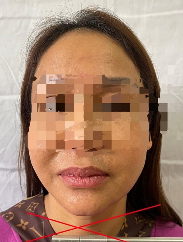 Bị can Lê Thị Hậu.