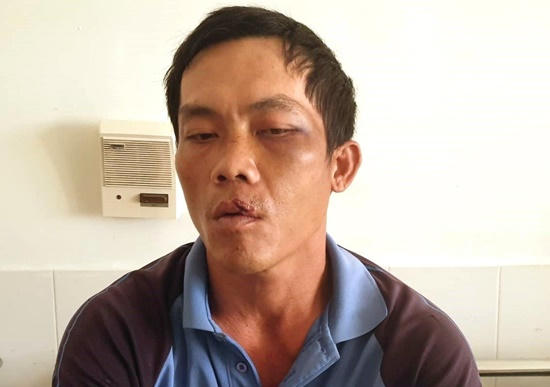 Anh Phương khi đang điều trị tại Bệnh viện Đa khoa tỉnh Phú Yên.