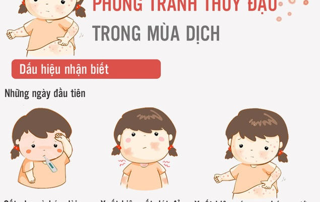 Inforgraphics: Bí kíp sống khỏe giữa mùa dịch thủy đậu