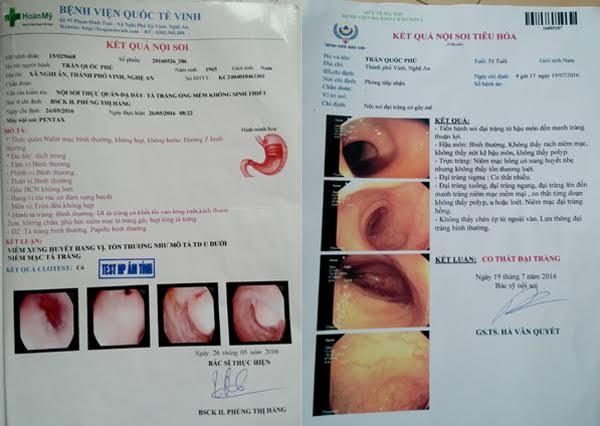Hình ảnh trước và sau khi phẫu thuật cắt khối u