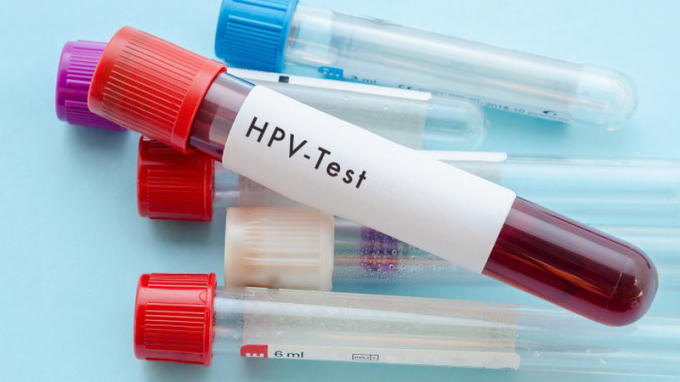 Virus HPV là một trong những nguyên nhân gây ung thư cổ tử cung.