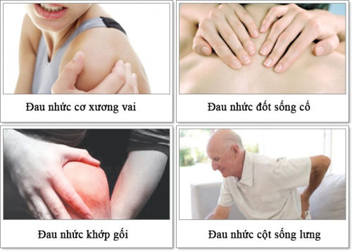 Các dạng đau nhức của bệnh liên quan đến xương khớp