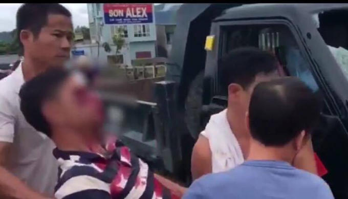 Người đàn ông bị ném vào mắt.  (Ảnh: Cắt từ clip).