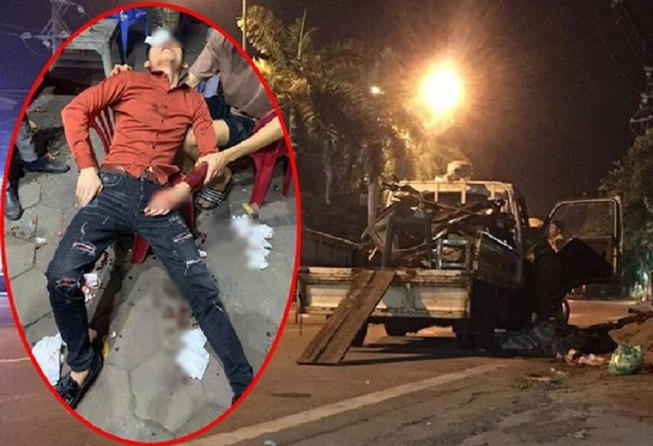 Hình ảnh C. bị thương ở vùng mặt được người dân sơ cứu.