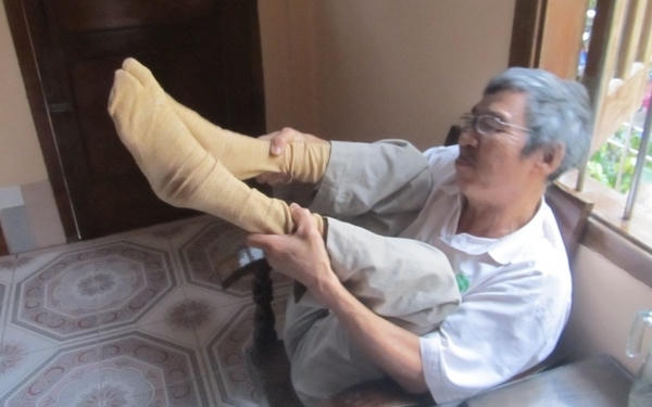 Những cơn co giật ở chân ông Lộc mỗi khi thay đổi thời tiết. (Ảnh: PV)