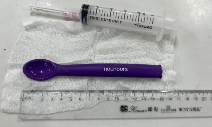 Chiếc thìa được bác sĩ gắp ra từ dạ dày người bệnh. Ảnh: BVCC.