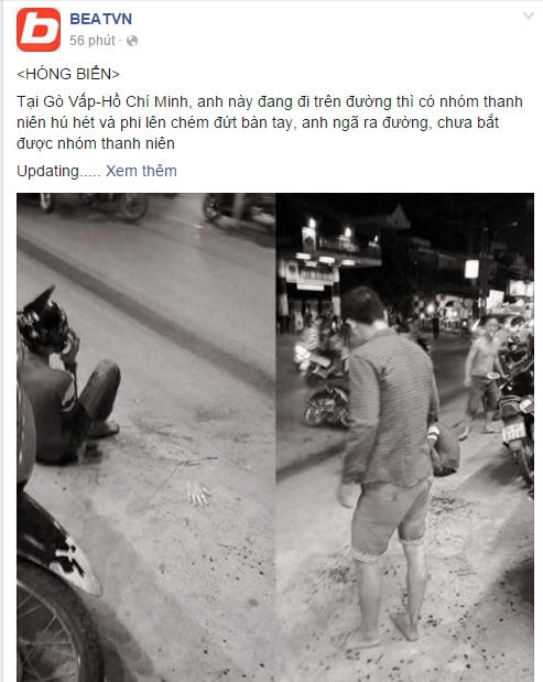 Thông tin vụ việc một nam thanh niên bị chém đứt lìa bàn tay là xôn xao cộng đồng mạng. Nguồn: Facebook.