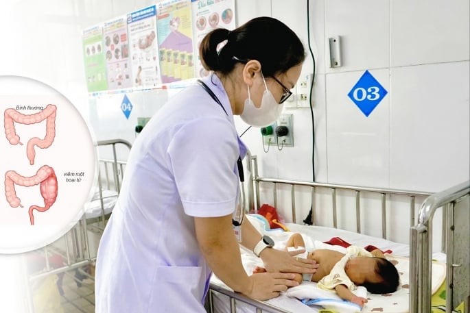 Kịp thời cứu sống trẻ sinh non bị viêm ruột hoại tử.
