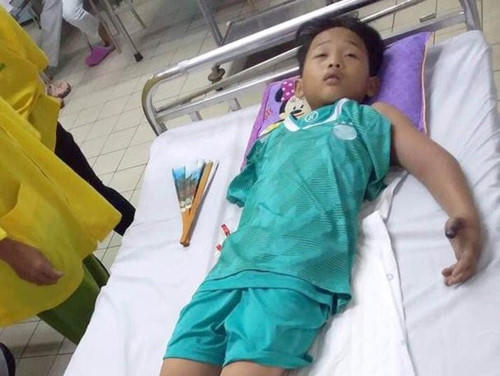 Cháu Huy đang nằm điều trị ở bệnh viện