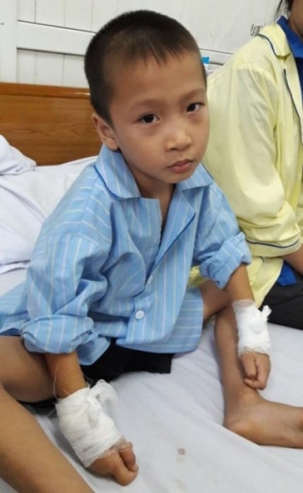 Cậu bé bị bác sĩ mổ nhầm tay.