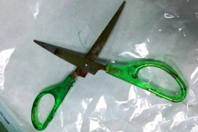 be-gai-o-nghe-an-bi-keo-nhon-gam-sau-3cm-vao-dau-1