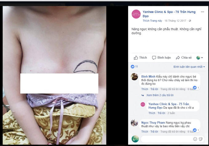 Một cảnh quảng cáo phẫu thuật nâng ngực tại Yanhee Clinic & Spa.