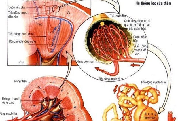 Nhận biết bệnh thận mạn để kịp thời chữa trị