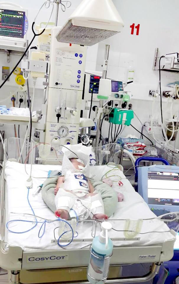 Bé trai may mắn được cứu sống. Ảnh: BVCC