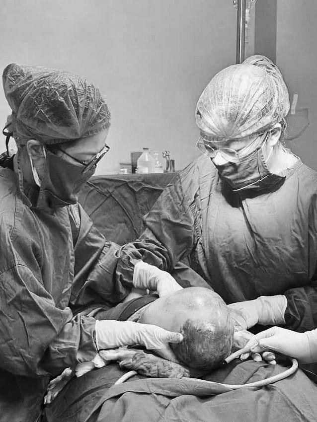 Bé trai chào đời còn nguyên trong bọc ối. Ảnh Bệnh viện cung cấp