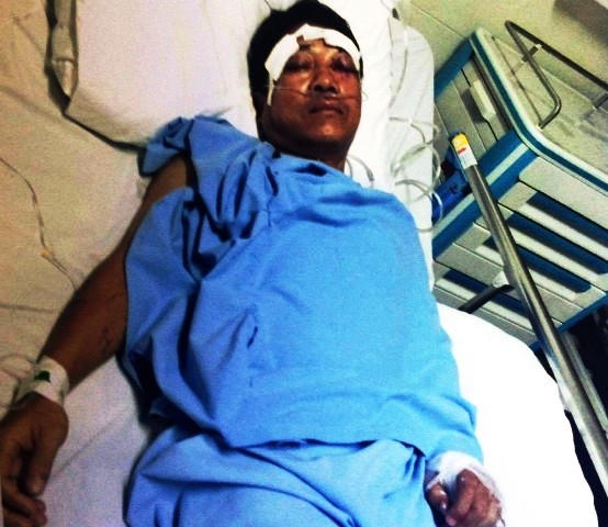 Bị hại Nguyễn Hữu Hoàng khi đang điều trị tại Bệnh viện. (Ảnh: anh Hoàng cung cấp)