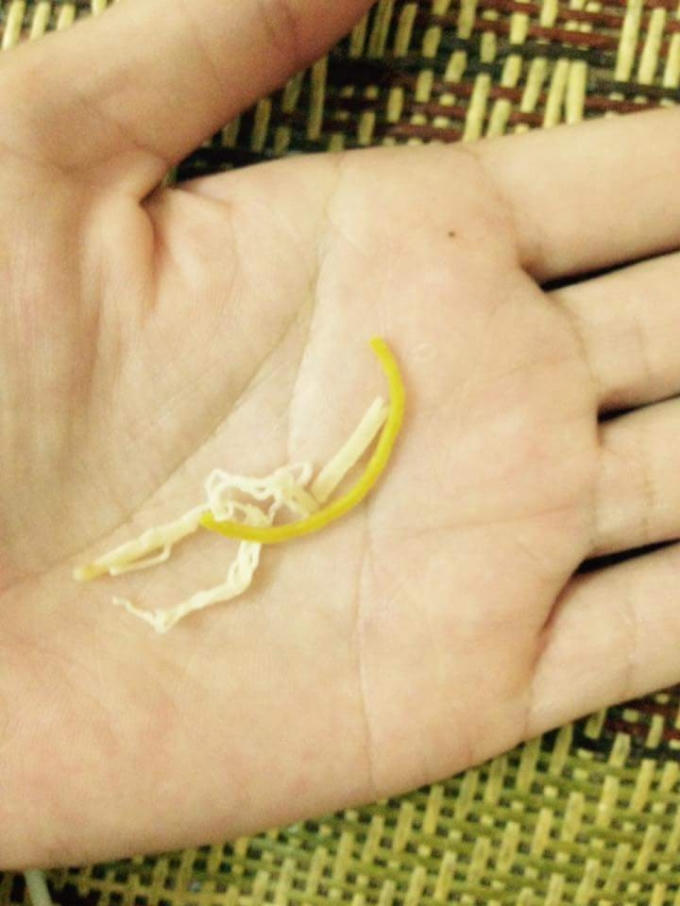 Sợi ruốc đã hóa thành cao su.