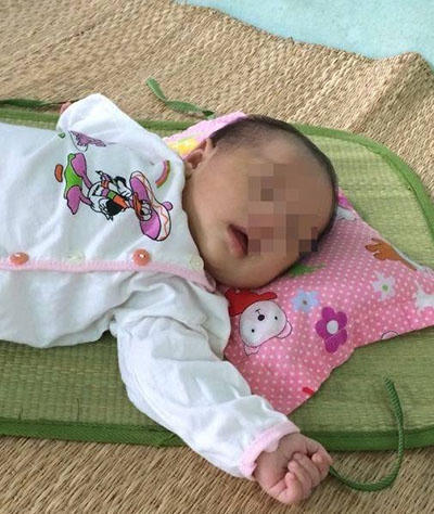 Bé Nguyễn Trọng V. (36 ngày tuổi) đã hoàn toàn khỏe mạnh và phát triển bình tường như những trẻ khác.