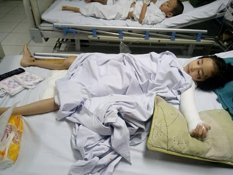 Hiền Minh với nghị lực phi thường, vượt qua nỗi đau khiến người khác yên tâm. (Ảnh: Thành Lâm)