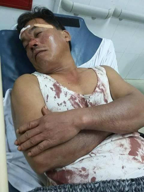 Anh Trung bị đánh trọng thương khi can ngăn hai nhóm trai làng đánh nhau.