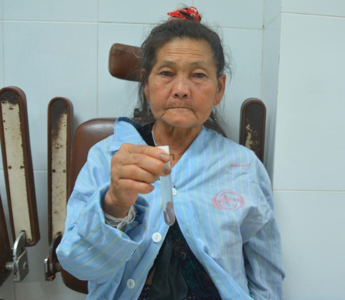 Bà xa và con đỉa được gắp ra từ đường thở của mình.