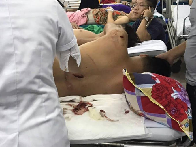 Nạm nhân Đoàn Thanh Liêm bị nhiều vết đâm chém trên người.