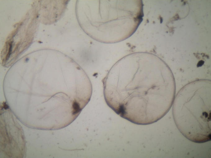 Tảo Noctiluca scintillans được soi dưới kính hiển vi (ảnh do Sở TN&amp;MT cung cấp).