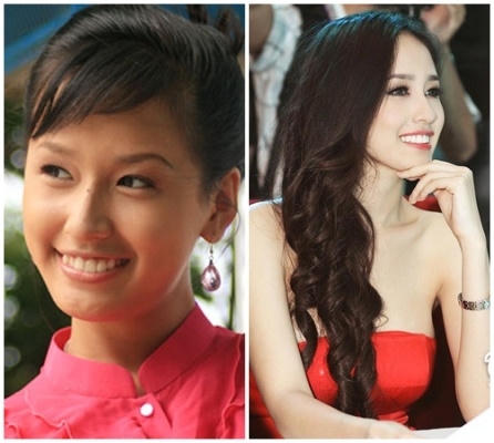 Hoa hậu Mai Phương Thúy trước khi đăng quang sở hữu làn da ngăm đen và hàm răng không đều. Ảnh: internet.