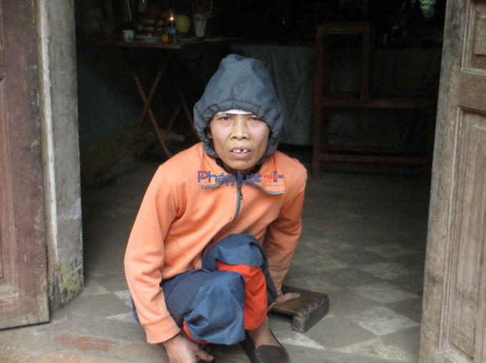 Bà Độ bị khớp và di chứng từ nhỏ nên mọi hoạt động của cô đều phải lê đôi bàn chân từng bước một (Ảnh: Thu Hường