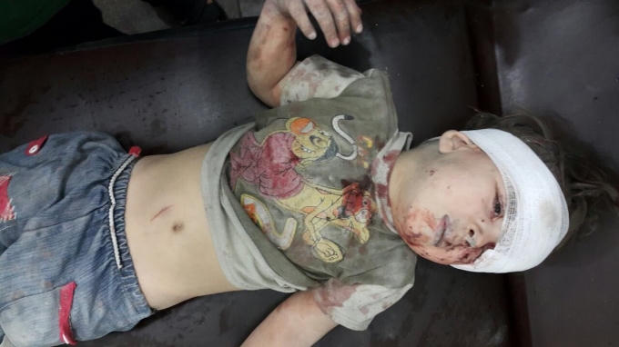 Hiện tại Omran đã được băng bó vết thương và đưa tới 1 nơi an toàn. (Ảnh: Raf Sanchez)