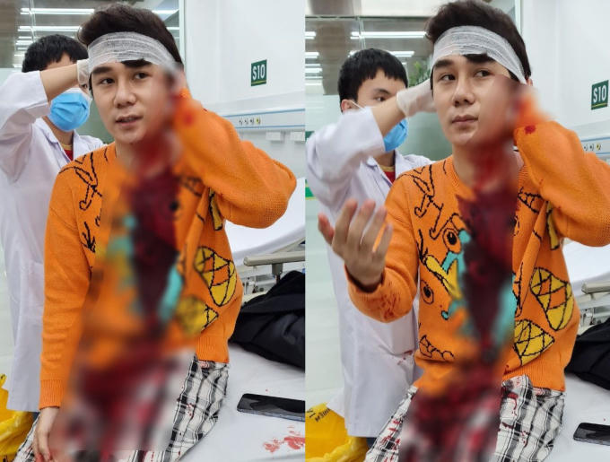 Diễn viên Ngô Sỹ Lâm với vết thương trên đầu .