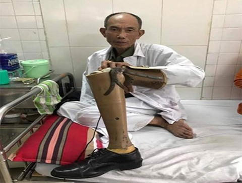 Ông Vin hiện vẫn đang được điều trị tại Bệnh viên Quân y 103.