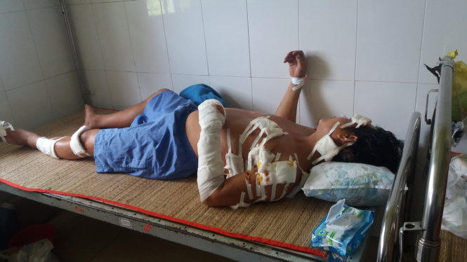 Anh Giang đang được điều trị tại bệnh viện (Ảnh: báo Tuổi trẻ)
