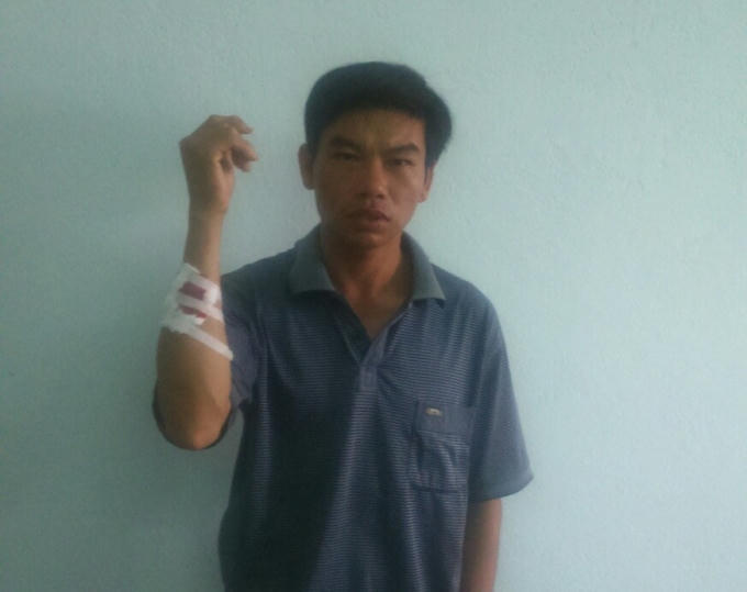 Châu Ngọc Lý với vết thương do cuộc xô xát gây ra