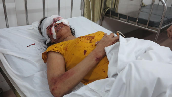 Trong đó có một số hành khách bị thương nặng.